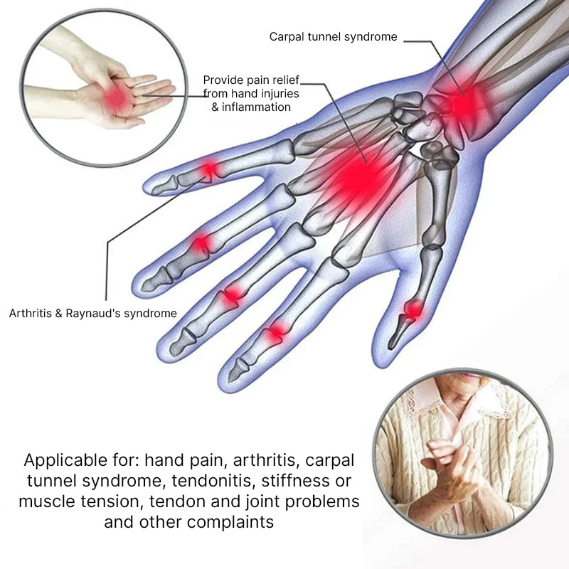 Fingerless Compression Gloves for Flexible & Pain-Free Hands – VitalGrip